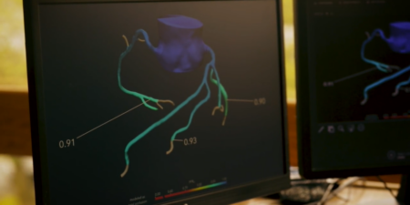 MultiCare's Pulse Heart Institute Now Offering Noninvasive HeartFlow Testing