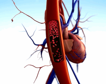 What is blood pressure? (video)