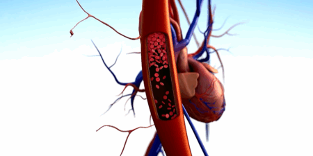 What is blood pressure? (video)