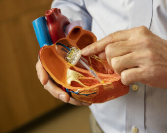 The TAVR procedure explained