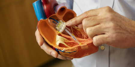 The TAVR procedure explained