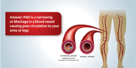 Cardiac Rehabilitation Education 6